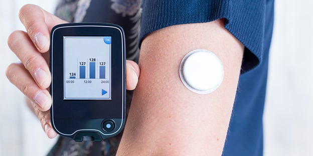 How to read your CGM data